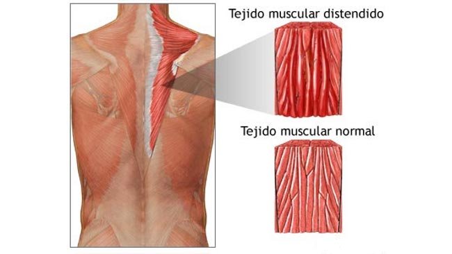 Masajes descontracturantes: una solución natural para el estrés- Masajes en Panana