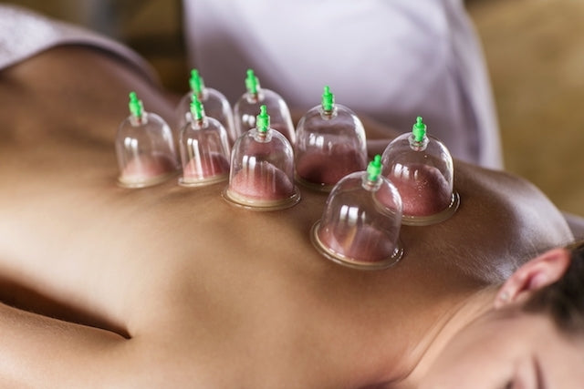 Terapia Ventosas Ventosas Para Masajes Beneficios Acupuntura